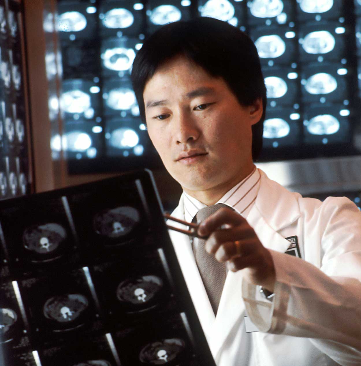 A man in a white coat assesses a collection of xrays.